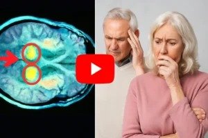 The Sciatica Warning Sign No One Talks About