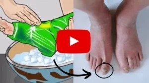 Failed Back Surgery? This May Be Why