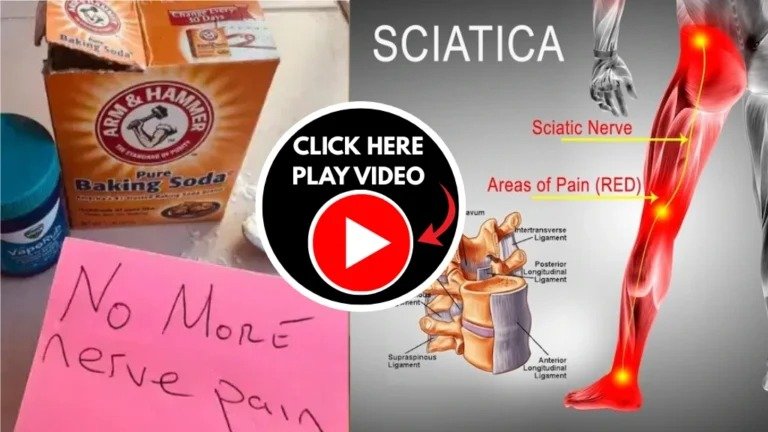 Sciatica Pain Relief